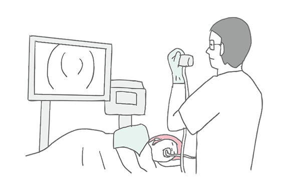 上部消化管内視鏡検査（胃カメラ）について